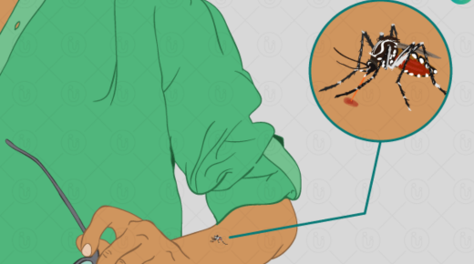 Ayurvedic Treatment for Joint Pain After Chikungunya - Natural Remedies for Relief