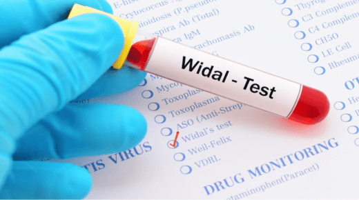 Widal blood test at home