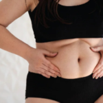 Tummy Tuck Surgery In Bangalore