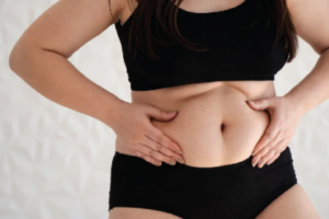 Tummy Tuck Surgery In Bangalore