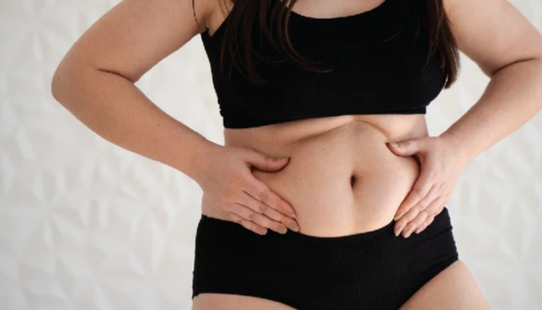 Tummy Tuck Surgery In Bangalore