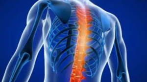 Spondylosis Treatment