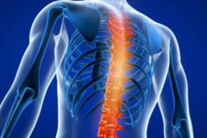 Spondylosis Treatment