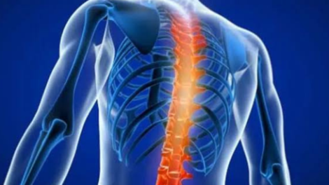 Spondylosis Treatment