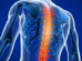 Spondylosis Treatment