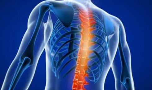 Spondylosis Treatment